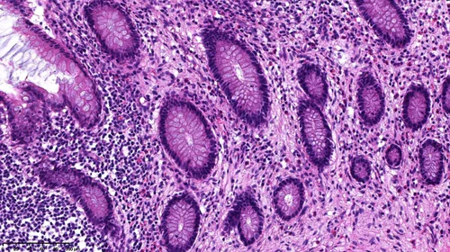 3D view of the appendix mucosa as a result of hematoxylin and eosin staining.