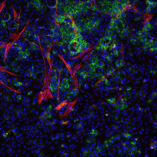 Human liver cell and human hepatic stellate cell in 3D view.