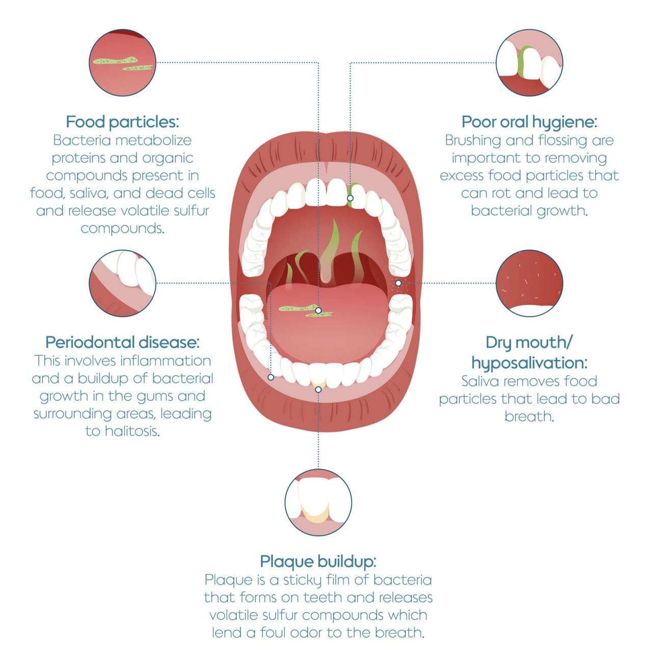 Effects of Smoking on Oral Health Visual