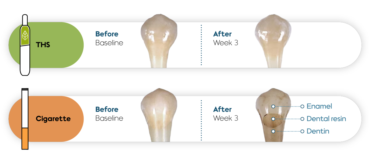 Before-and-after images of human teeth and dental resin restorations.