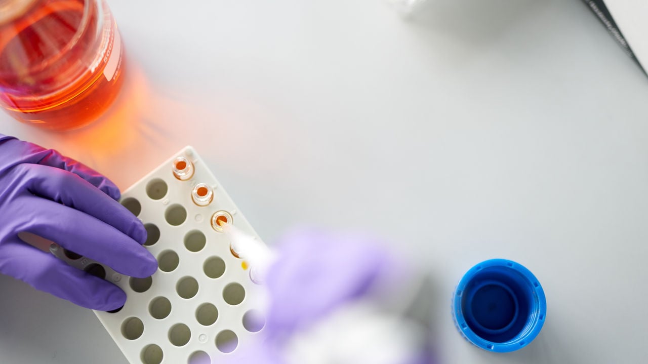 A scientist with purple rubber gloves holds a test with orange liquid.